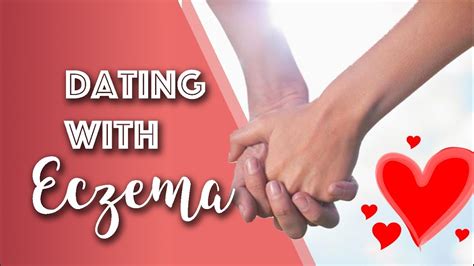 dating eczema